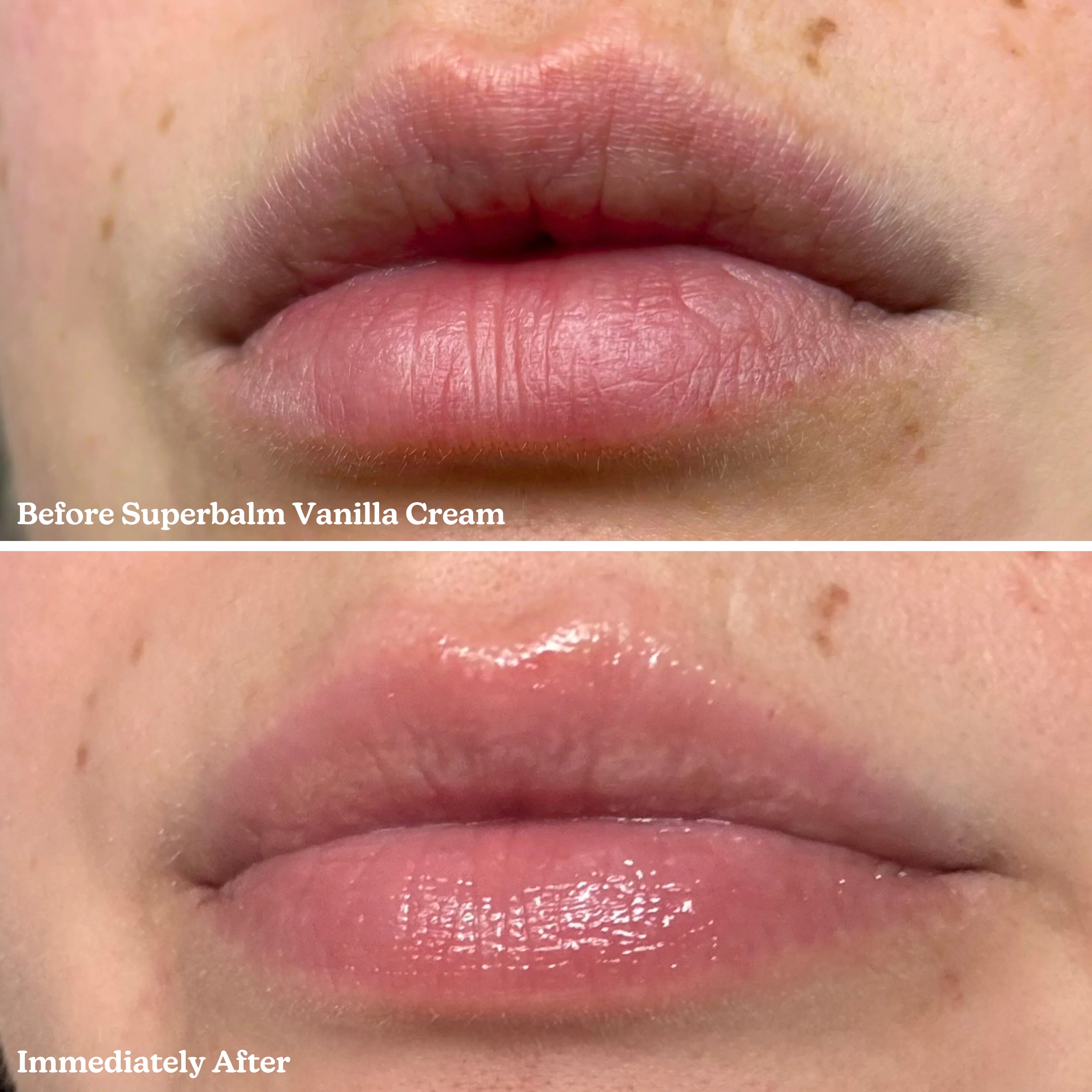 Superbalm Tripeptide-1 Vanilla Lip Balm - Image 10