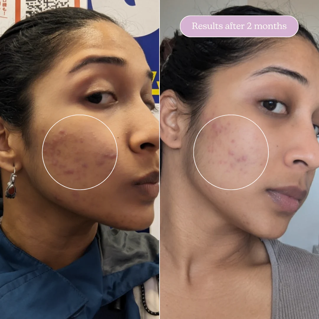 The Ultimate Clear Skin Edit - Image 26